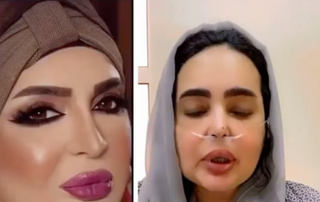 صعوبة الوضع الصحي لـ بدرية احمد 